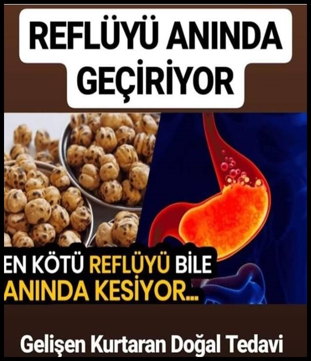 Mide Yanması ve Reflüyü Doğal Yollar ile Tedavi Edin! galerisi resim 1