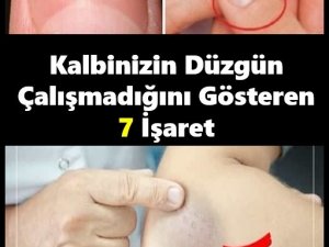 Kalbinizin Düzgün Çalışmadığını Gösteren O İ'şaretler.