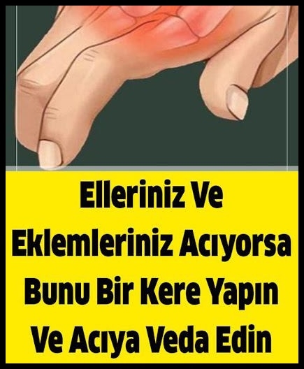 Elleriniz Ve Eklemleriniz Acıyorsa Bunu Bir Kere Yapın galerisi resim 1